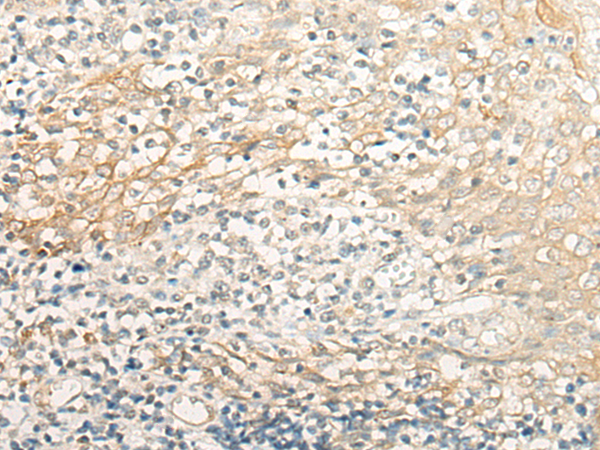 Immunohistochemistry of paraffin-embedded Human tonsil tissue using TA370040 (CRB3 Antibody) at dilution 1/30 (Original magnification: x200)