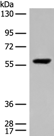Gel: 8%SDS-PAGE Lysate: 40 microg Lane: HepG2 cell lysate Primary antibody: TA370057 (DALRD3 Antibody) at dilution 1/550 Secondary antibody: Goat anti rabbit IgG at 1/8000 dilution Exposure time: 20 seconds