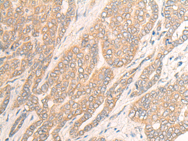 Anti-ENDOG mouse monoclonal antibody (TA504189) immunofluorescent staining of COS7 cells transiently transfected by pCMV6-ENTRY ENDOG (RC205089).
