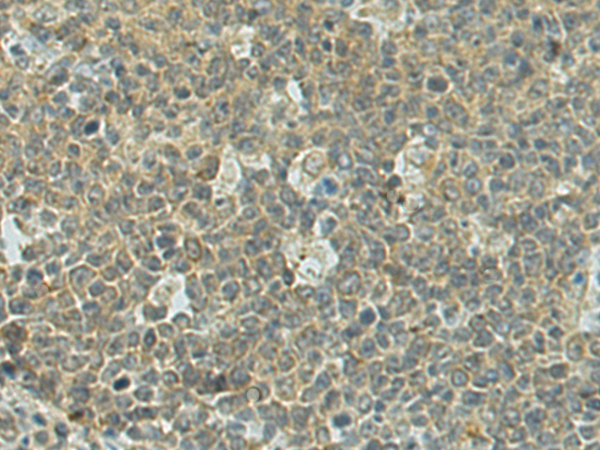 Immunohistochemistry of paraffin-embedded Human tonsil tissue using TA370089 (DENND1A Antibody) at dilution 1/50 (Original magnification: x200)