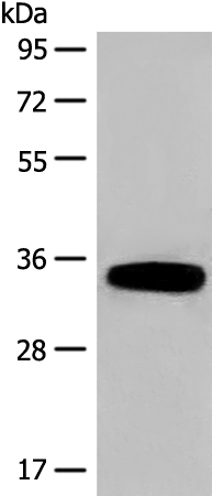 Gel: 8%SDS-PAGE Lysate: 40 microg Lane: Human fetal liver tissue lysate Primary antibody: TA370126 (DHRS1 Antibody) at dilution 1/400 Secondary antibody: Goat anti rabbit IgG at 1/8000 dilution Exposure time: 1 minute