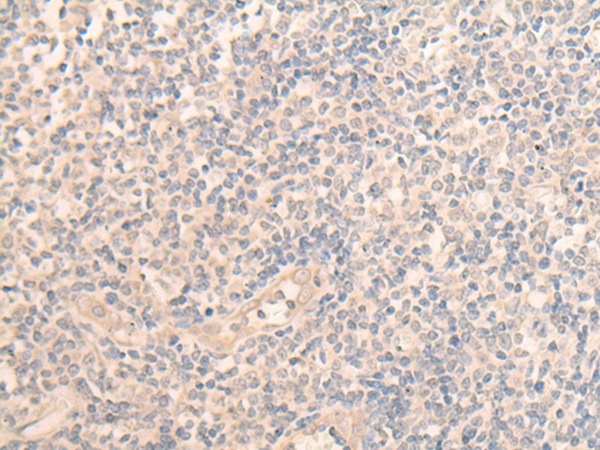 Immunohistochemistry of paraffin-embedded Human tonsil tissue using TA370175 (PLEKHA1 Antibody) at dilution 1/30 (Original magnification: x200)