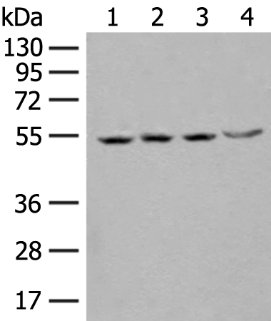Gel: 8%SDS-PAGE Lysate: 40 microg Lane 1-4: Jurkat Raji 293T and HEPG2 cell lysates Primary antibody: TA370227 (SHMT2 Antibody) at dilution 1/200 Secondary antibody: Goat anti rabbit IgG at 1/8000 dilution Exposure time: 3 seconds