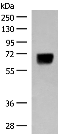 Gel: 8%SDS-PAGE Lysate: 40 microg Lane: Human thyroid tissue lysate Primary antibody: TA370298 (DGLUCY Antibody) at dilution 1/250 Secondary antibody: Goat anti rabbit IgG at 1/8000 dilution Exposure time: 20 seconds