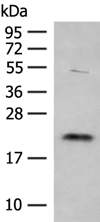 Gel: 12%SDS-PAGE Lysate: 40 microg Lane: HEPG2 cell lysate Primary antibody: TA370318 (TIMM22 Antibody) at dilution 1/250 Secondary antibody: Goat anti rabbit IgG at 1/8000 dilution Exposure time: 30 seconds