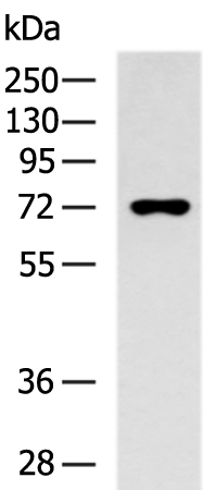 Gel: 8%SDS-PAGE Lysate: 40 microg Lane: HL-60 cell lysate Primary antibody: TA370406 (MAN1B1 Antibody) at dilution 1/800 Secondary antibody: Goat anti rabbit IgG at 1/5000 dilution Exposure time: 1 minute