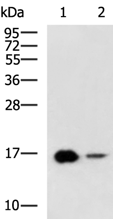 Gel: 12%SDS-PAGE Lysate: 40 microg Lane 1-2: Rat heart tissue Mouse skeletal muscle tissue lysates Primary antibody: TA370453 (LBH Antibody) at dilution 1/800 Secondary antibody: Goat anti rabbit IgG at 1/5000 dilution Exposure time: 5 minutes