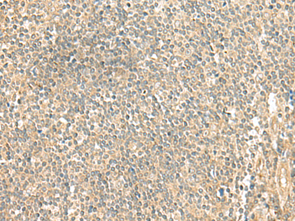 Immunohistochemistry of paraffin-embedded Human tonsil tissue using TA370463 (LMO3 Antibody) at dilution 1/50 (Original magnification: x200)