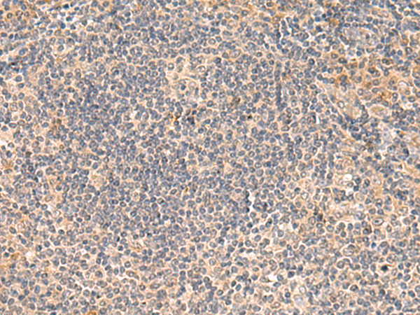 Immunohistochemistry of paraffin-embedded Human tonsil tissue using TA370499 (FUNDC2 Antibody) at dilution 1/50 (Original magnification: x200)