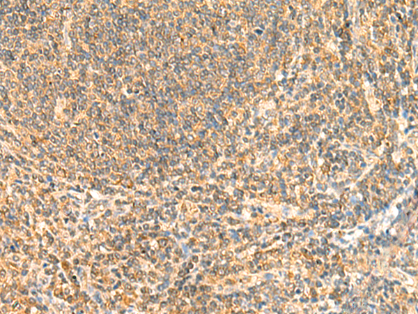 Immunohistochemistry of paraffin-embedded Human tonsil tissue using TA370503 (ZNF581 Antibody) at dilution 1/50 (Original magnification: x200)