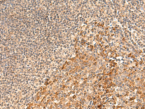 Immunohistochemistry of paraffin-embedded Human tonsil tissue using TA370540 (GALNT12 Antibody) at dilution 1/60 (Original magnification: x200)