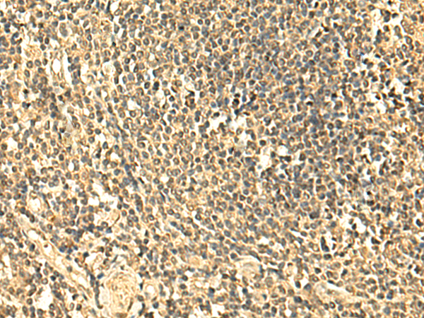 Immunohistochemistry of paraffin-embedded Human tonsil tissue using TA370543 (UNKL Antibody) at dilution 1/50 (Original magnification: x200)