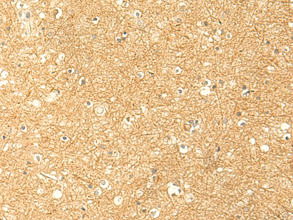 Immunohistochemistry of paraffin-embedded Human brain tissue using TA370547 (RNF148 Antibody) at dilution 1/50 (Original magnification: x200)