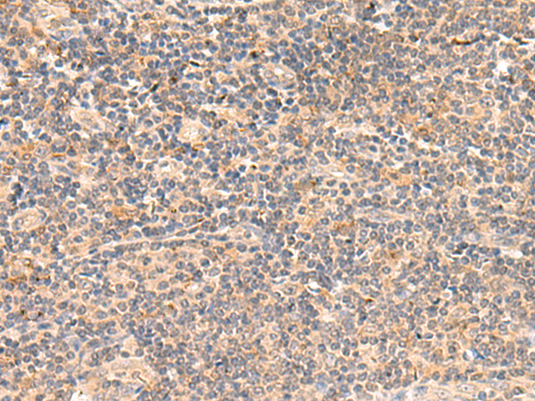 Immunohistochemistry of paraffin-embedded Human tonsil tissue using TA370559 (TEAD3 Antibody) at dilution 1/50 (Original magnification: x200)