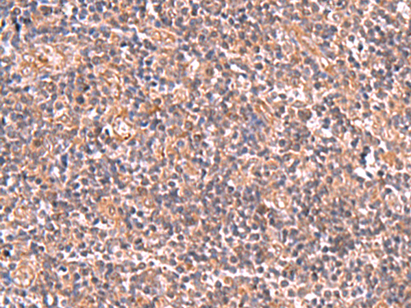 HEK293T cells were transfected with the pCMV6-ENTRY control (Left lane) or pCMV6-ENTRY VBP1 (RC208482, Right lane) cDNA for 48 hrs and lysed. Equivalent amounts of cell lysates (5 ug per lane) were separated by SDS-PAGE and immunoblotted with anti-VBP1. Positive lysates LY418727 (100 ug) and LC418727 (20 ug) can be purchased separately from OriGene.