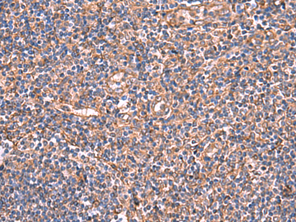 Immunohistochemistry of paraffin-embedded Human tonsil tissue using TA370643 (TTC38 Antibody) at dilution 1/50 (Original magnification: x200)