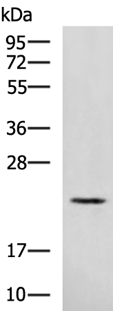 Gel: 12%SDS-PAGE Lysate: 40 microg Lane: Mouse brain tissue lysate Primary antibody: TA370777 (RAB39A Antibody) at dilution 1/500 Secondary antibody: Goat anti rabbit IgG at 1/5000 dilution Exposure time: 2 minutes
