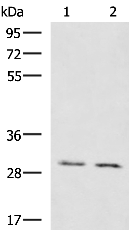 Gel: 8%SDS-PAGE Lysate: 40 microg Lane 1-2: Mouse brain tissue Mouse kidney tissue lysates Primary antibody: TA370806 (KRCC1 Antibody) at dilution 1/1350 Secondary antibody: Goat anti rabbit IgG at 1/5000 dilution Exposure time: 1 minute