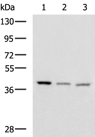 Gel: 8%SDS-PAGE Lysate: 40 microg Lane 1-3: Human cerebrum tissue Human cerebella tissue Mouse brain tissue lysates Primary antibody: TA370856 (ENKD1 Antibody) at dilution 1/1150 Secondary antibody: Goat anti rabbit IgG at 1/5000 dilution Exposure time: 3 minutes