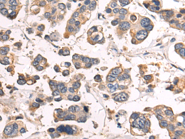 Immunohistochemistry of paraffin-embedded Human tonsil tissue using TA370872 (POC1A Antibody) at dilution 1/40 (Original magnification: x200)