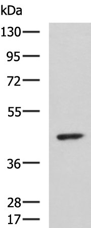 Gel: 8%SDS-PAGE Lysate: 40 microg Lane: Hela cell lysate Primary antibody: TA370878 (ARPC1B Antibody) at dilution 1/1000 Secondary antibody: Goat anti rabbit IgG at 1/5000 dilution Exposure time: 10 minutes