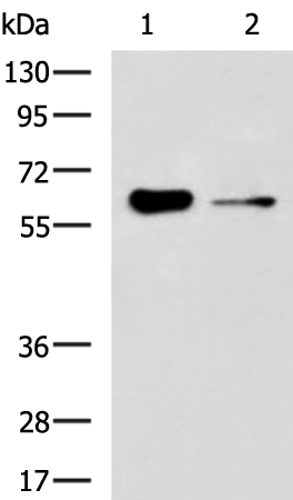 Gel: 8%SDS-PAGE Lysate: 40 microg Lane 1-2: HUVEC cell Mouse kidney tissue lysates Primary antibody: TA370949 (FRMD5 Antibody) at dilution 1/1000 Secondary antibody: Goat anti rabbit IgG at 1/5000 dilution Exposure time: 3 minutes