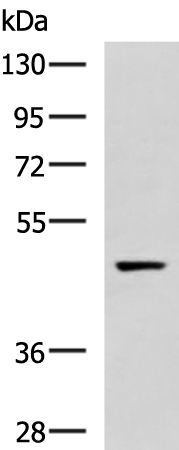 Gel: 8%SDS-PAGE Lysate: 40 microg Lane: 293T cell lysate Primary antibody: TA370989 (GLT8D1 Antibody) at dilution 1/800 Secondary antibody: Goat anti rabbit IgG at 1/5000 dilution Exposure time: 20 seconds