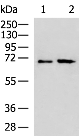 Gel: 8%SDS-PAGE Lysate: 40 microg Lane 1-2: A549 and Hela cell lysates Primary antibody: TA371017 (RPUSD2 Antibody) at dilution 1/700 Secondary antibody: Goat anti rabbit IgG at 1/5000 dilution Exposure time: 3 minutes