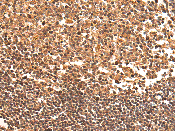 Immunohistochemistry of paraffin-embedded Human tonsil tissue using TA371038 (TSR1 Antibody) at dilution 1/70 (Original magnification: x200)