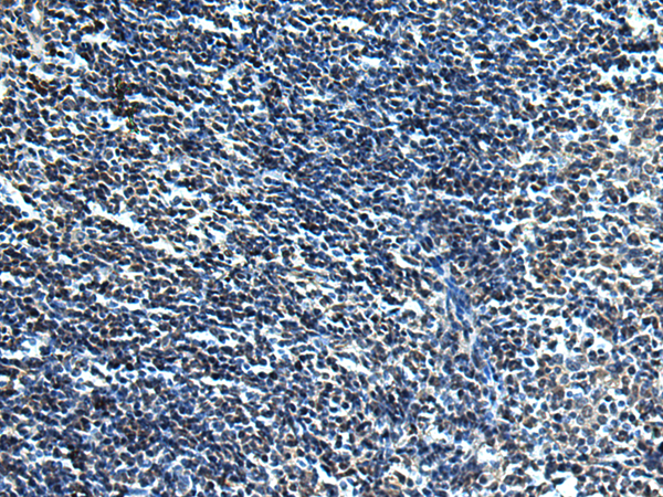 Immunohistochemistry of paraffin-embedded Human tonsil tissue using TA371123 (SLC2A12 Antibody) at dilution 1/30 (Original magnification: x200)