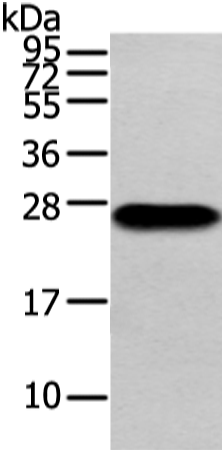 Gel: 12%SDS-PAGE Lysate: 40 microg Lane: Human plasma solution Primary antibody: TA371184 (Lambda Light chain Antibody) at dilution 1/200 Secondary antibody: Goat anti rabbit IgG at 1/8000 dilution Exposure time: 10 seconds