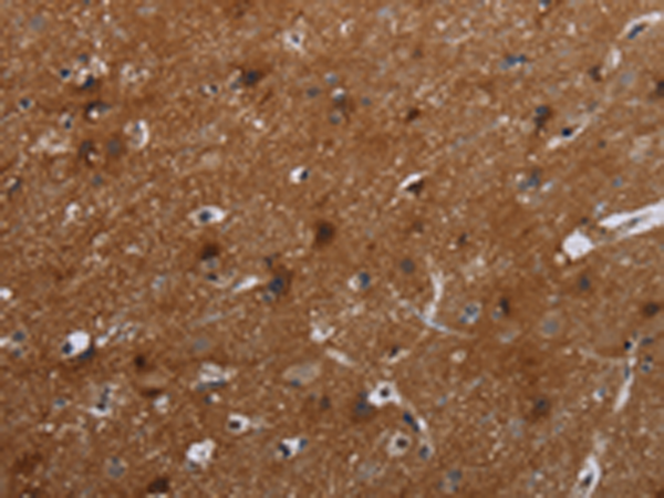 Immunohistochemistry of paraffin-embedded Human brain tissue using TA371350 (FMN2 Antibody) at dilution 1/20 (Original magnification: x200)