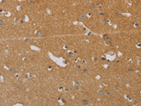 Immunohistochemistry of paraffin-embedded Human brain tissue using TA371399 (KIF4A Antibody) at dilution 1/40 (Original magnification: x200)