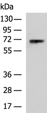 Gel: 8%SDS-PAGE Lysate: 40 microg Lane: A431 cell lysate Primary antibody: TA371469 (POU6F2 Antibody) at dilution 1/500 Secondary antibody: Goat anti rabbit IgG at 1/5000 dilution Exposure time: 1 minute