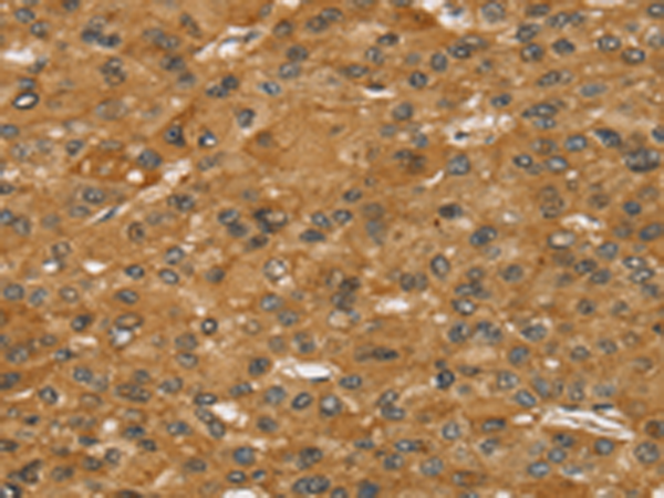 Anti-ACAA2 mouse monoclonal antibody (TA506126) immunofluorescent staining of COS7 cells transiently transfected by pCMV6-ENTRY ACAA2 (RC201096).