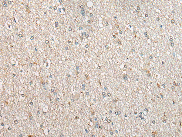 Immunohistochemistry of paraffin-embedded Human brain tissue using TA371589 (UGT1A4 Antibody) at dilution 1/30 (Original magnification: x200)