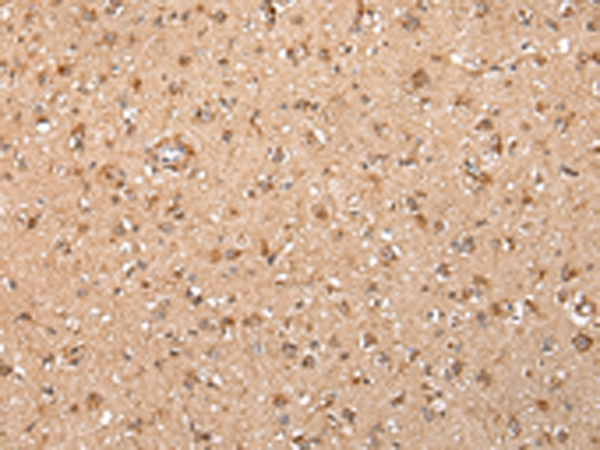 Immunohistochemistry of paraffin-embedded Human brain tissue using TA371624 (XKR7 Antibody) at dilution 1/20 (Original magnification: x200)
