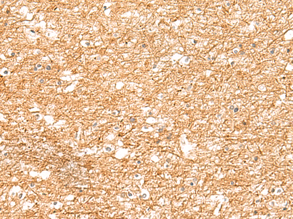 Immunohistochemistry of paraffin-embedded Human brain tissue using TA371630 (ZNF185 Antibody) at dilution 1/25 (Original magnification: x200)