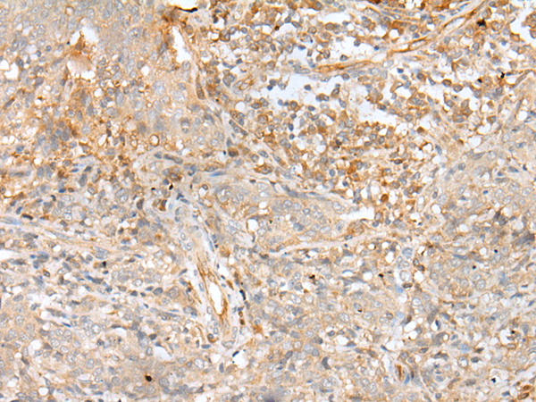 Immunofluorescent staining of HeLa cells using anti-EPCAM mouse monoclonal antibody (TA506626).