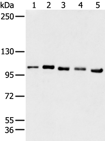 Gel: 6%SDS-PAGE Lysate: 40 microg Lane 1-5: Hela A431 Hepg-2 293T and Raji cell Primary antibody: TA371760 (GANAB Antibody) at dilution 1/200 Secondary antibody: Goat anti rabbit IgG at 1/8000 dilution Exposure time: 15 seconds