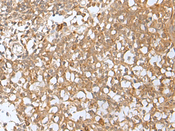 Immunohistochemistry of paraffin-embedded Human tonsil tissue using TA371762 (KMT2B Antibody) at dilution 1/20 (Original magnification: x200)