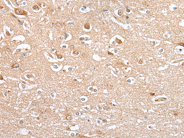 Immunohistochemistry of paraffin-embedded Human brain tissue using TA371796 (CES4A Antibody) at dilution 1/20 (Original magnification: x200)