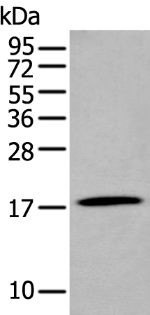Gel: 12%SDS-PAGE Lysate: 40 microg Lane: Human stomach tissue lysate Primary antibody: TA371893 (GKN2 Antibody) at dilution 1/250 Secondary antibody: Goat anti rabbit IgG at 1/8000 dilution Exposure time: 20 seconds
