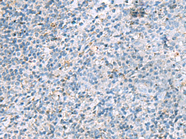 Immunohistochemistry of paraffin-embedded Human tonsil tissue using TA371931 (LRRC4 Antibody) at dilution 1/40 (Original magnification: x200)