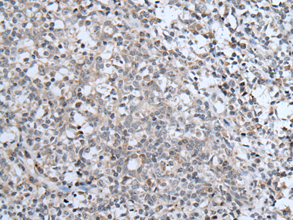 Immunohistochemistry of paraffin-embedded Human tonsil tissue using TA371953 (ABCA6 Antibody) at dilution 1/40 (Original magnification: x200)