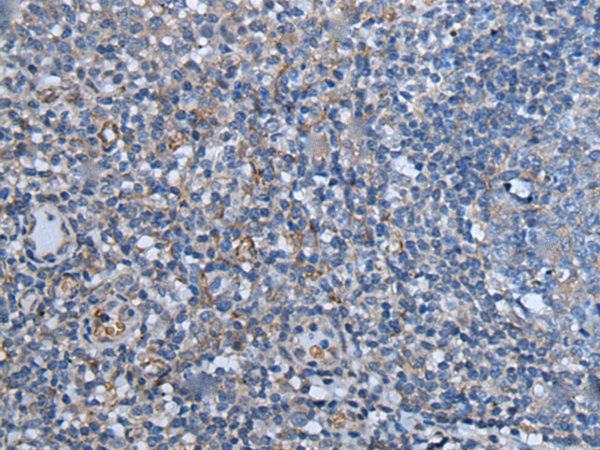 Immunohistochemistry of paraffin-embedded Human tonsil tissue using TA371960 (KLRK1 Antibody) at dilution 1/25 (Original magnification: x200)