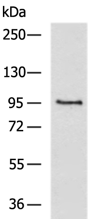 Gel: 6%SDS-PAGE Lysate: 40 microg Lane: PC3 cell lysate Primary antibody: TA371964 (KCNQ3 Antibody) at dilution 1/500 Secondary antibody: Goat anti rabbit IgG at 1/5000 dilution Exposure time: 40 seconds