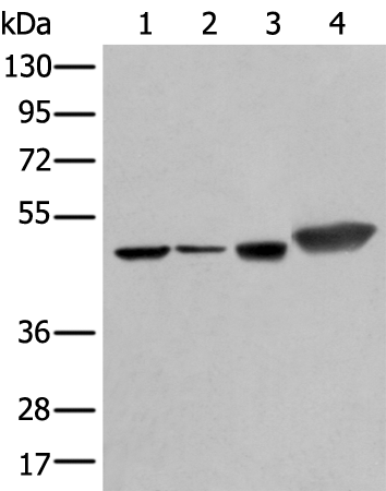 Gel: 8%SDS-PAGE Lysate: 40 microg Lane 1-4: Hepg2 A431 Hela and A549 cell lysates Primary antibody: TA371968 (PLAG1 Antibody) at dilution 1/250 Secondary antibody: Goat anti rabbit IgG at 1/8000 dilution Exposure time: 3 seconds