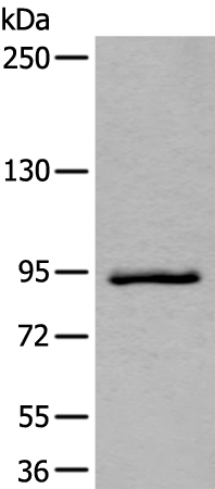 Gel: 6%SDS-PAGE Lysate: 40 microg Lane: Jurkat cell lysate Primary antibody: TA371988 (ZBTB10 Antibody) at dilution 1/800 Secondary antibody: Goat anti rabbit IgG at 1/8000 dilution Exposure time: 40 seconds