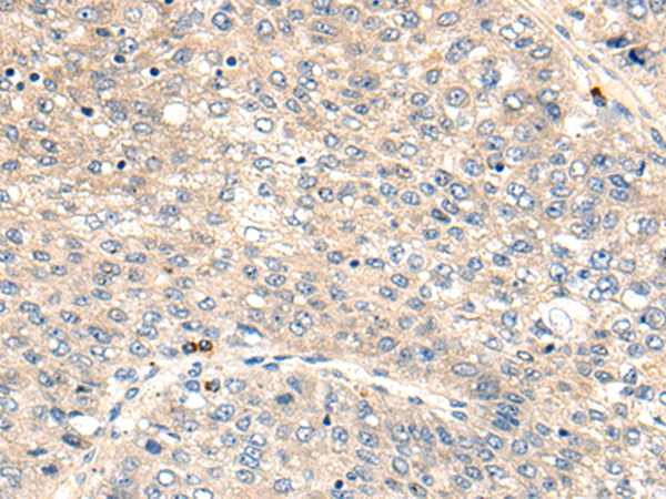 Immunohistochemical staining of paraffin-embedded Human liver tissue within the normal limits using anti-FGG mouse monoclonal antibody. (Heat-induced epitope retrieval by 1mM EDTA in 10mM Tris, pH8.5, 120°C for 3min, TA507155)